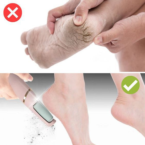 RÂPE ÉLECTRIQUE PROFESSIONNELLE POUR PIEDS